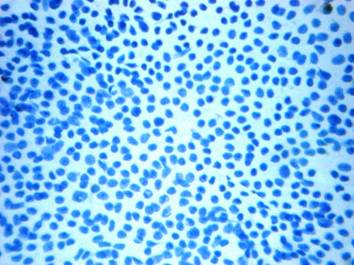 An insight on pediatric peripheral Lymphadenopathy: Atwo year cytological study in a tertiary care hospital